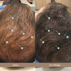 Hair Density Serum with Nanoxidil