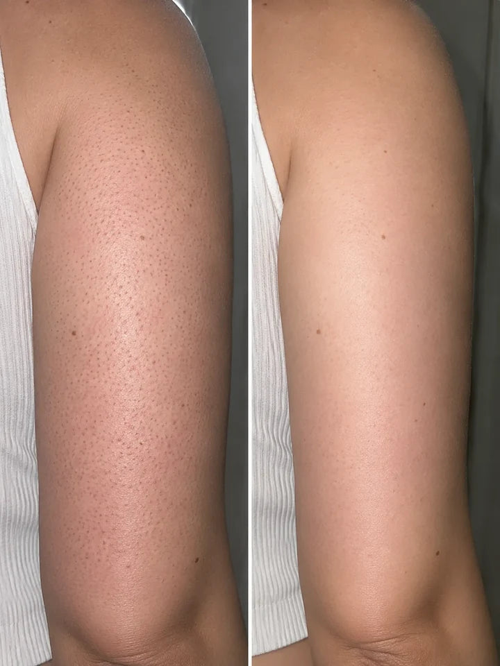 Customer before and after result