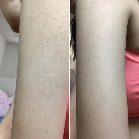 Customer before and after result